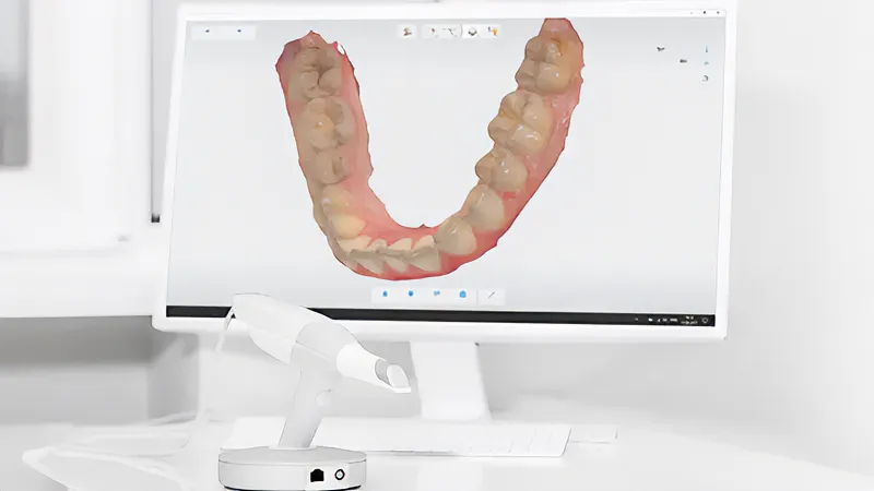 3d-scanner